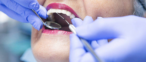 Best Emergency Dental Extractions in Sweetwater, FL